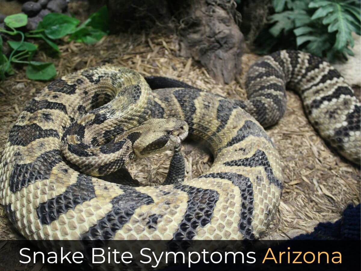 Snake Bite Symptoms Arizona